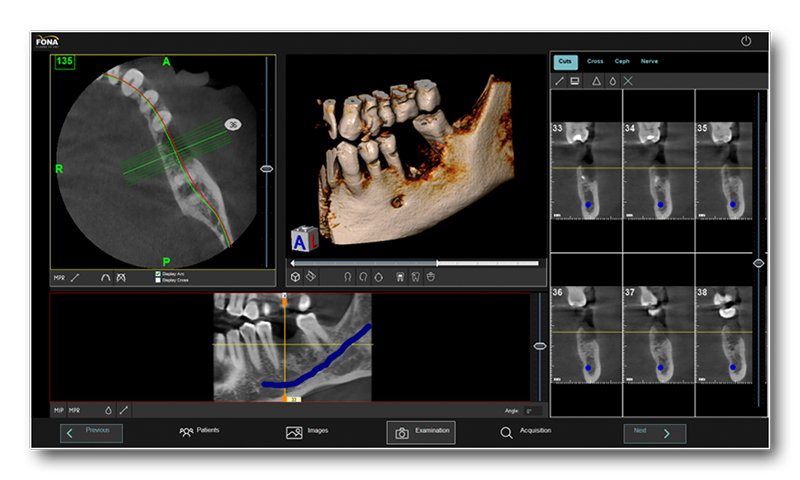 SERVIZI Diagnostica dentale tac e panoramica TC dental scan rs