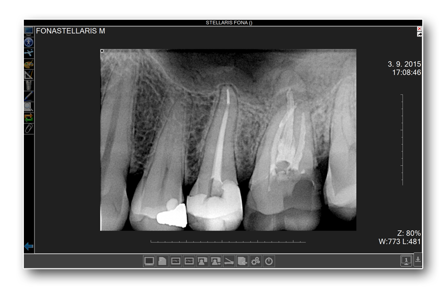 SERVIZI Diagnostica dentale tac e panoramica radiog endorale копия